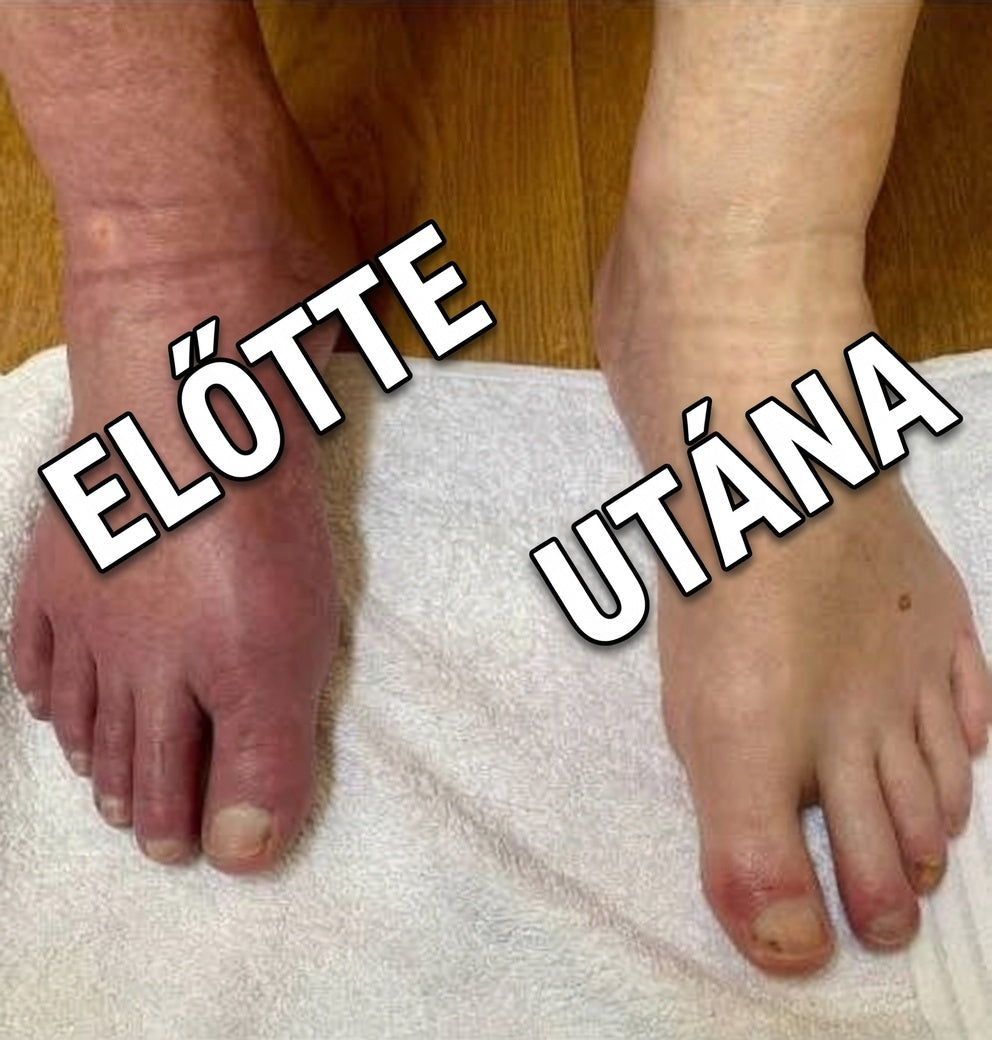 PrimeRelax Melegítő és Vibrációs Bokapánt Fáradt, Sajgó Lábakra